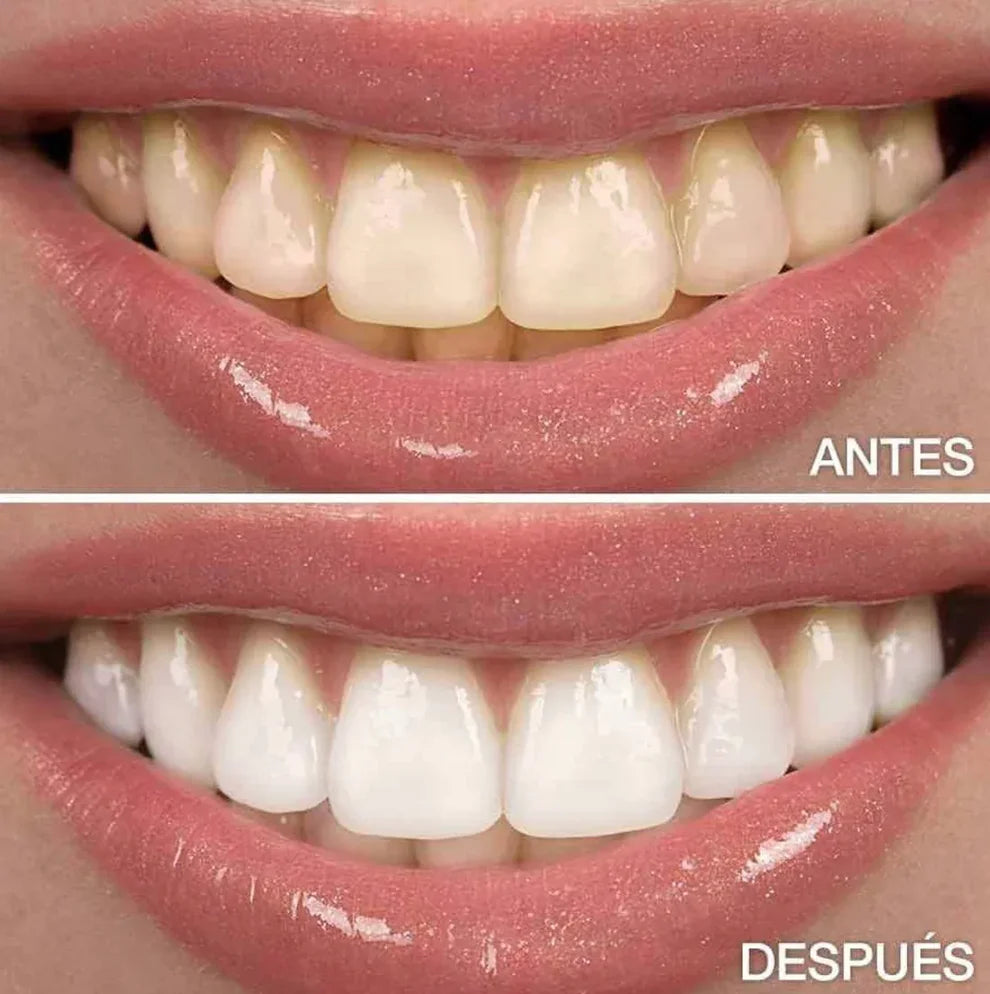 Nubeira™ V34 - Blanquea y Refresca tu Sonrisa en casa